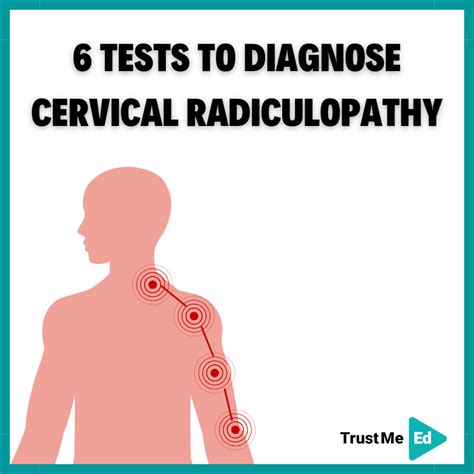 cervical radiculopathy compression test|cervical radiculopathy physical exam findings.